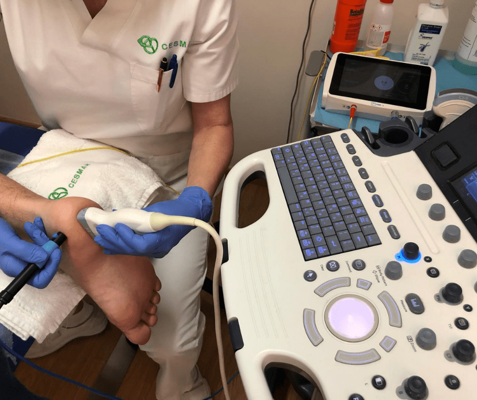 electrólisis percutánea musculoesquelética
