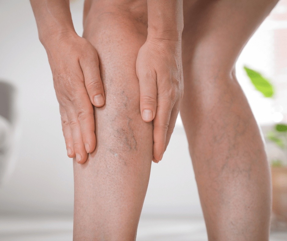 problemas circulatorios venosos