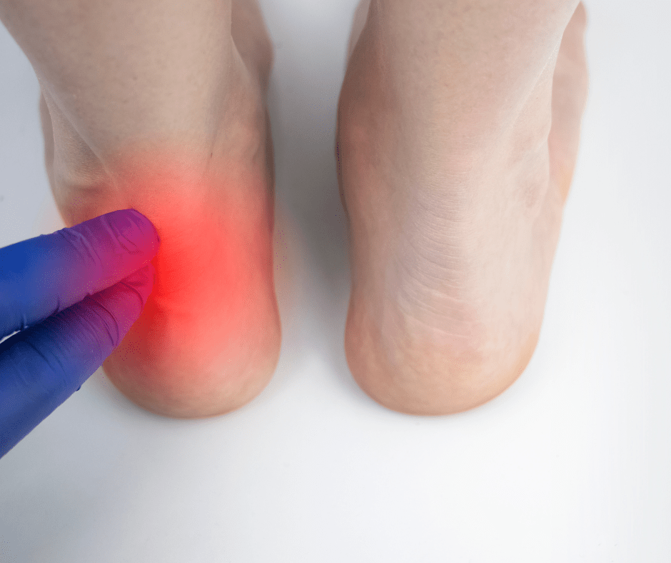 tendinopatía de aquiles